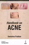 Handbook on Acne cover