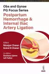 Obs and Gynae PG Focus Series: Postpartum Hemorrhage and Internal Iliac Artery Ligation cover