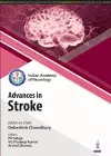 Recent Advances in Stroke cover