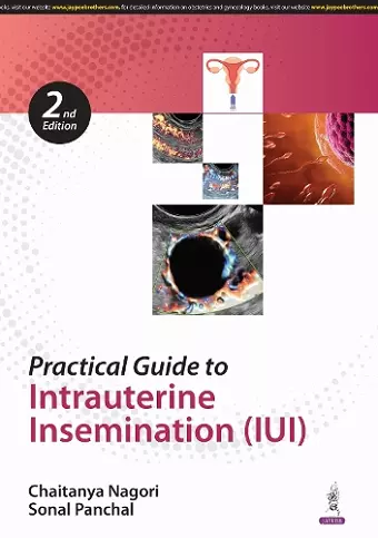 Practical Guide to Intrauterine Insemination (IUI) cover