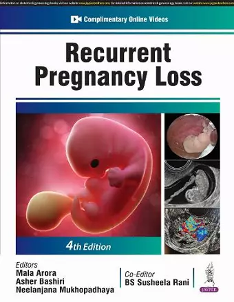 Recurrent Pregnancy Loss cover