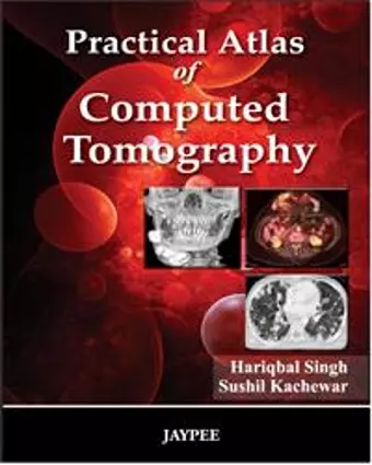 Practical Atlas of Computed Tomography cover