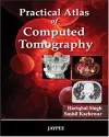 Practical Atlas of Computed Tomography cover