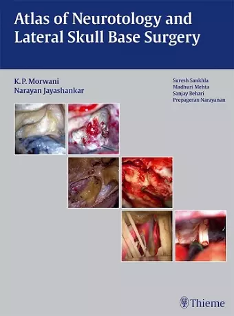 Atlas of Neurotology and Lateral Skull Base Surgery cover