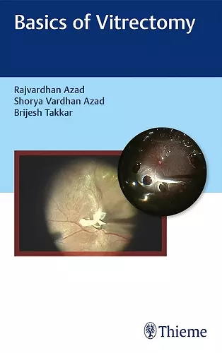 Basics of Vitrectomy cover