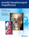 Juvenile Nasopharyngeal Angiofibroma cover