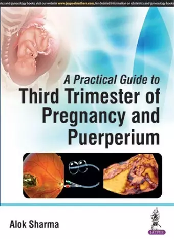 A Practical Guide to Third Trimester of Pregnancy & Puerperium cover