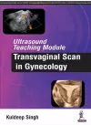 Ultrasound Teaching Module: Transvaginal Scan in Gynecology cover