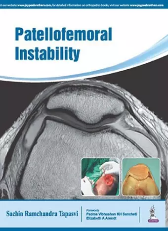 Patellofemoral Instability cover