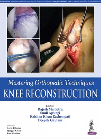 Mastering Orthopedic Techniques: Knee Reconstruction cover