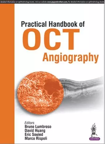 Practical Handbook of OCT Angiography cover