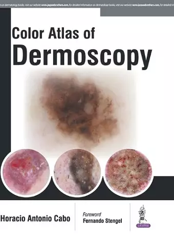 Color Atlas of Dermoscopy cover