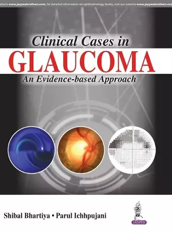 Clinical Cases in Glaucoma cover