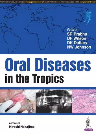 Oral Diseases in the Tropics cover