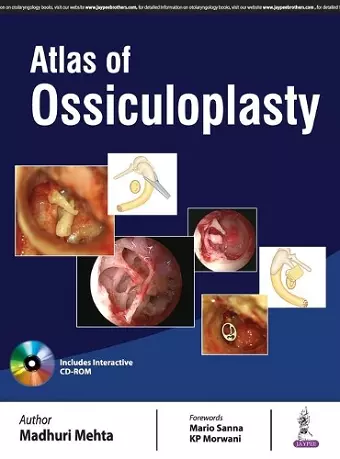 Atlas of Ossiculoplasty cover