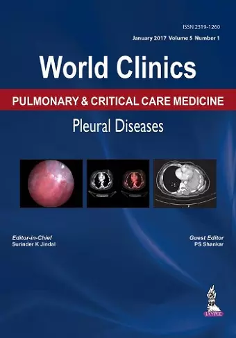 World Clinics: Pulmonary & Critical Care Medicine: Pleural Diseases cover