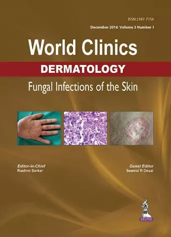 World Clinics Dermatology: Fungal Infections of the Skin cover