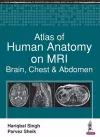 Atlas of Human Anatomy on MRI cover