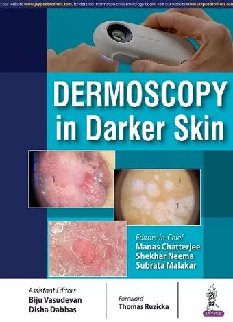 Dermoscopy in Darker Skin cover