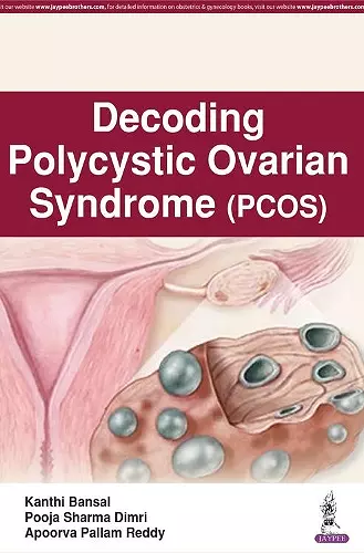 Decoding Polycystic Ovarian Syndrome cover