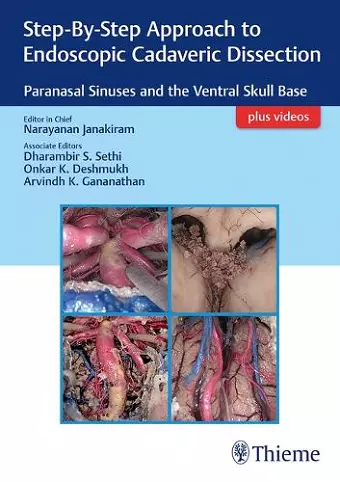 Step-by-Step Approach to Endoscopic Cadaveric Dissection, Ed 1 cover