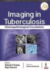 Imaging in Tuberculosis cover