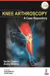 Knee Arthroscopy cover