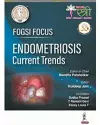 FOGSI Focus Endometriosis: Current Trends cover