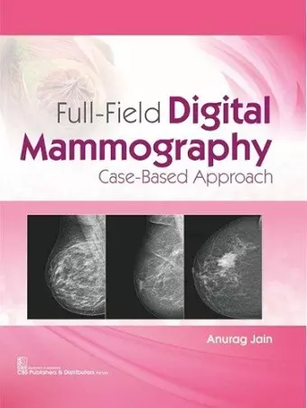 Full-Field Digital Mammography cover