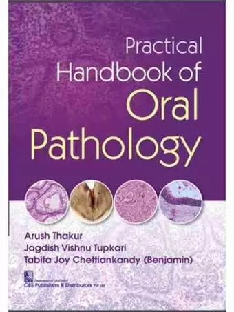 Practical Handbook of Oral Pathology cover