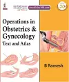 Operations in Obstetrics & Gynecology cover