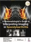 A Rheumatologist's Guide to Interpreting Imaging in Spondyloarthritis cover