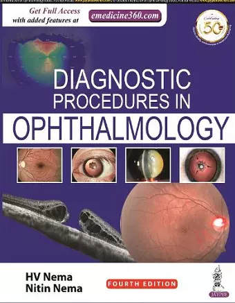 Diagnostic Procedures in Ophthalmology cover