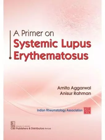 A Primer on Systemic Lupus Erythematosus cover