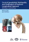 Cervical Spondylotic Myelopathy and Ossification of Posterior Longitudinal Ligament cover