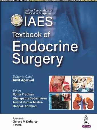 Textbook of Endocrine Surgery cover