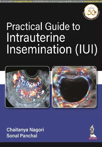 Practical Guide to Intrauterine Insemination (IUI) cover