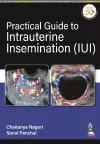 Practical Guide to Intrauterine Insemination (IUI) cover