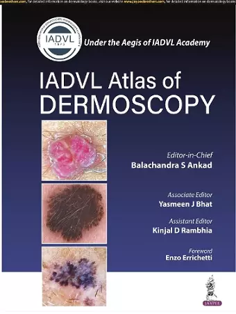 Atlas of Dermoscopy cover