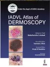 Atlas of Dermoscopy cover