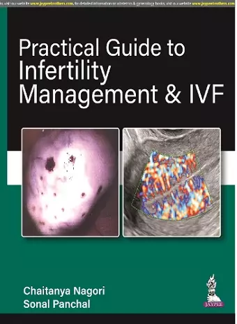 Practical Guide to Infertility Management & IVF cover