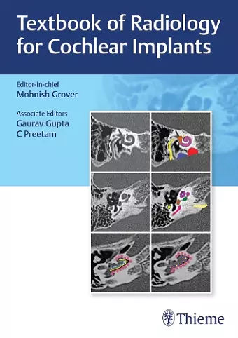 Textbook of Radiology for Cochlear Implants cover