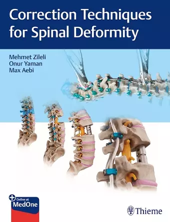 Correction Techniques for Spinal Deformity cover