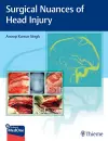 Surgical Nuances of Head Injury cover