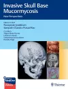 Invasive Skull Base Mucormycosis cover
