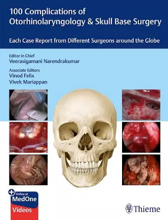 100 Complications of Otorhinolaryngology & Skull Base Surgery cover