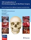 100 Complications of Otorhinolaryngology & Skull Base Surgery cover