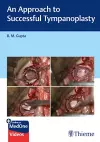 An Approach to Successful Tympanoplasty cover