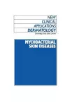 Mycobacterial Skin Diseases cover