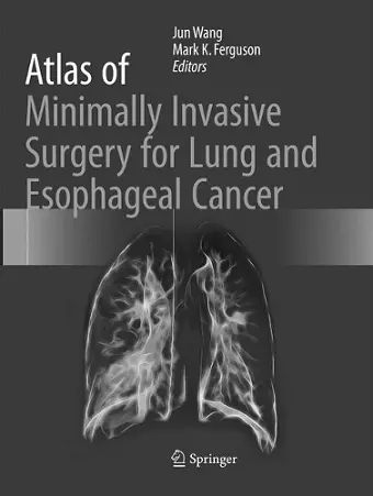 Atlas of Minimally Invasive Surgery for Lung and Esophageal Cancer cover